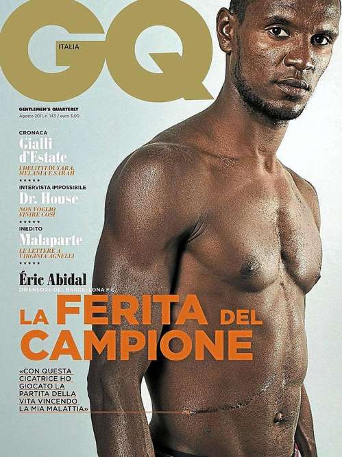 eric abidal shows his scar.jpg